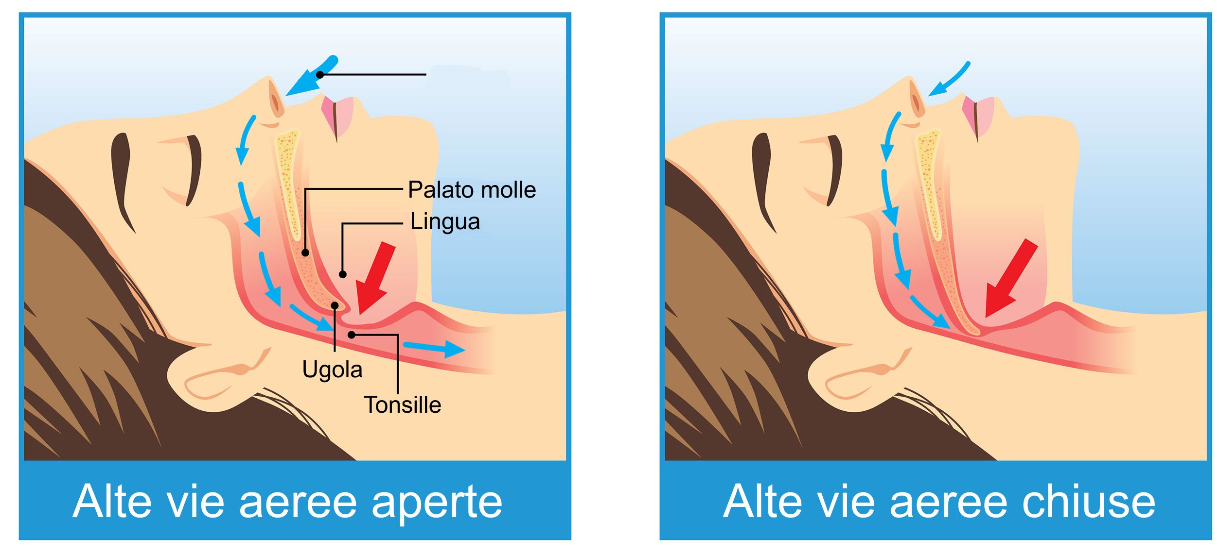 4 domande per capire l’apnea del sonno