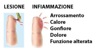 INFIAMMAZIONE-LESIONE