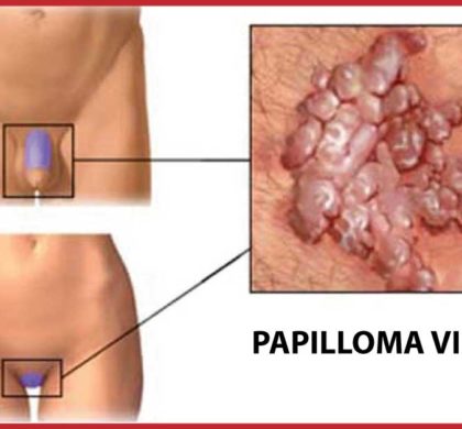 Parliamo di Papilloma Virus