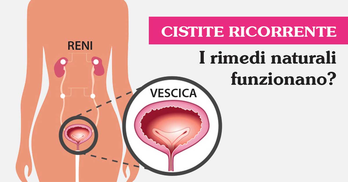 I rimedi naturali contro la cistite ricorrente nella donna